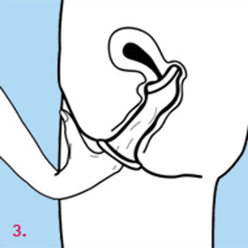 Femidom 3 Pc-FC2